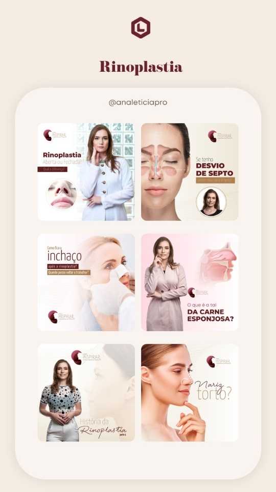 Portfólio Rinoplastia